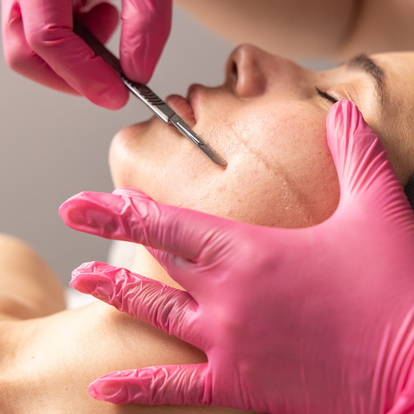 Professional dermaplaning training